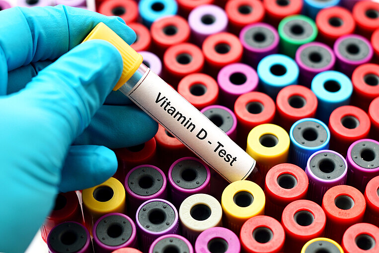 Vitamin-D Bluttest Vitamin-D Bluttest