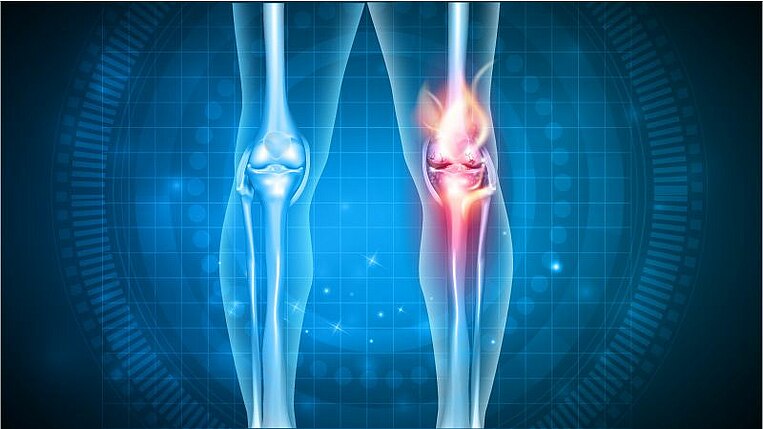 Illustration des menschlichen Beines mit Kennzeichnung des Kniegelenks Illustration des menschlichen Beines mit Kennzeichnung des Kniegelenks