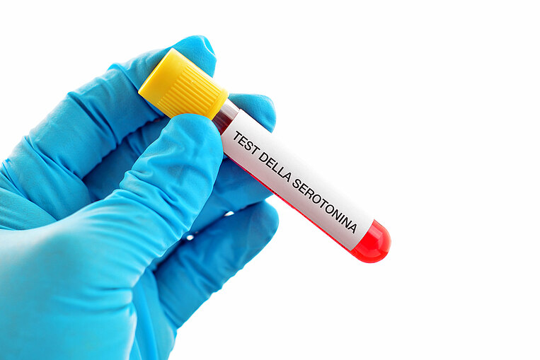 Provetta con la scritta Test della serotonina Provetta con la scritta Test della serotonina