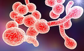Come trattare in modo naturale la candida intestinale