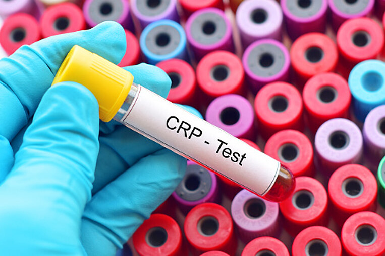 CRP-Test CRP-Test