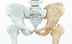 NEWS: Eine neue Studie behauptet: Vitamin D erhöht die Knochendichte von Senioren nicht