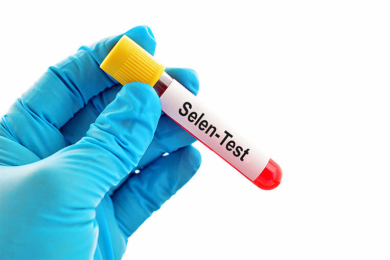 Blutprobe mit der Aufschrift Selen Test  Blutprobe mit der Aufschrift Selen Test