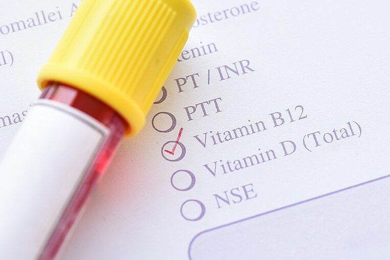 Valori di un test di laboratorio sulla vitamina B12 Valori di un test di laboratorio sulla vitamina B12