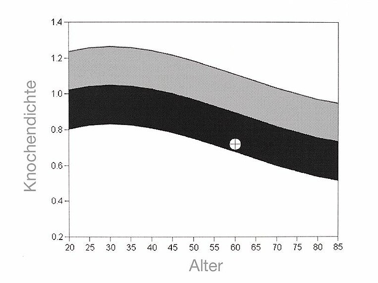 Grafik der Knochendichte Grafik der Knochendichte