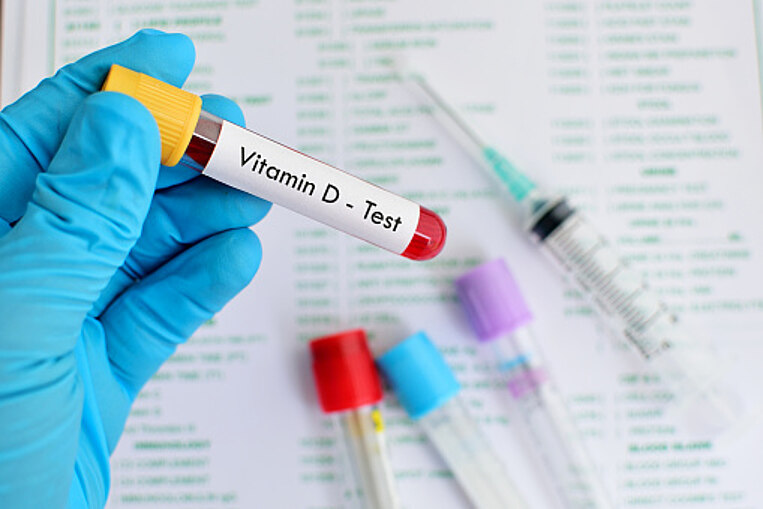 Vitamin-D-Bluttest Vitamin-D-Bluttest