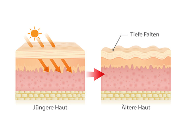 Illustrative Darstellung von verschiedenen Hautschichten bei jüngerer und älterer Haut Illustrative Darstellung von verschiedenen Hautschichten bei jüngerer und älterer Haut