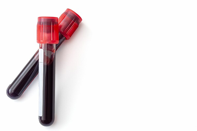 zwei Blutproben zwei Blutproben