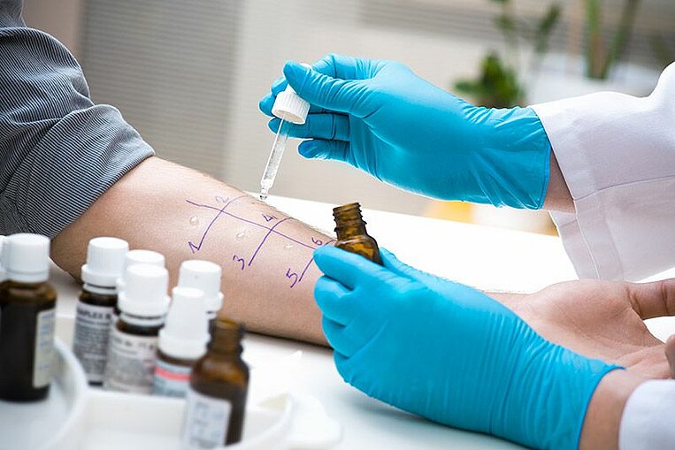 Arzt macht einen Allergietest auf dem Arm eines Patienten Arzt macht einen Allergietest auf dem Arm eines Patienten