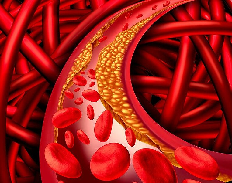 Illustration einer Arterie Illustration einer Arterie