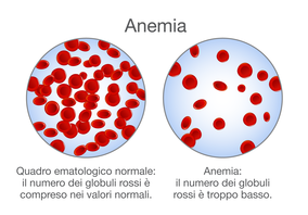 Confronto tra il numero di globuli rossi di una persona anemica e di una sana