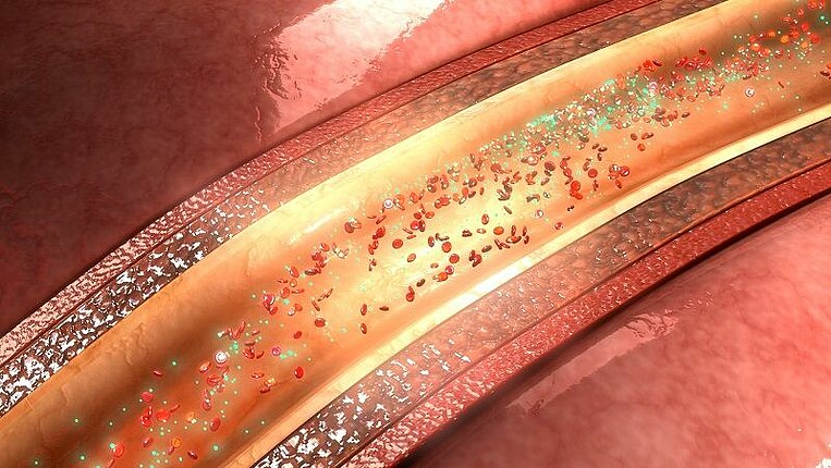 Illustration Querschnitt einer Arterie Illustration Querschnitt einer Arterie