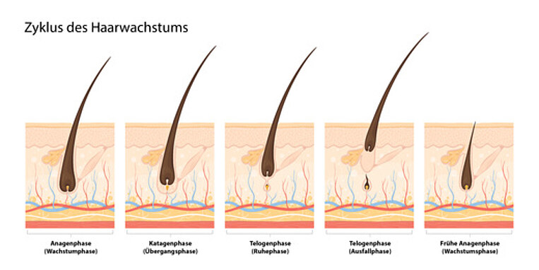 Illustration des Haarwachstumszyklus Illustration des Haarwachstumszyklus