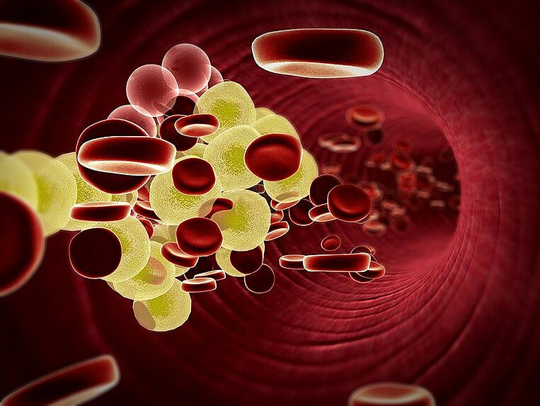 Illustration von Cholesterin im Blut Illustration von Cholesterin im Blut