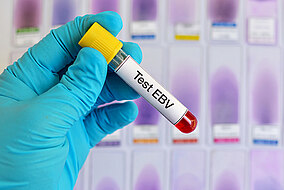 Test dell’EBV in laboratorio