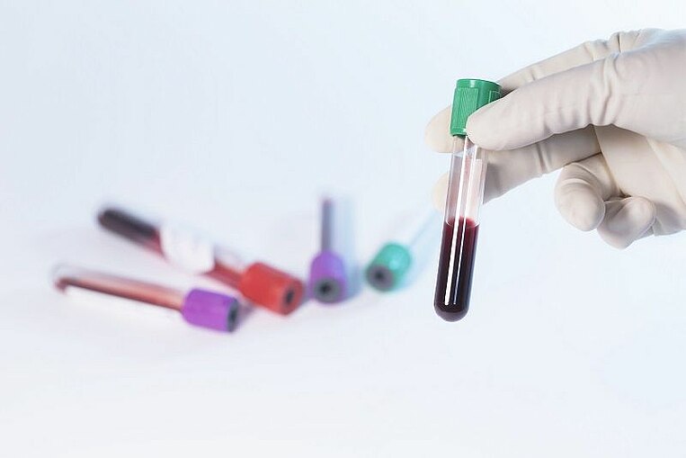 Eine Ampulle mit Blut wird in den Vordergrund gehalten während im Hintergrund weitere liegen Eine Ampulle mit Blut wird in den Vordergrund gehalten während im Hintergrund weitere liegen