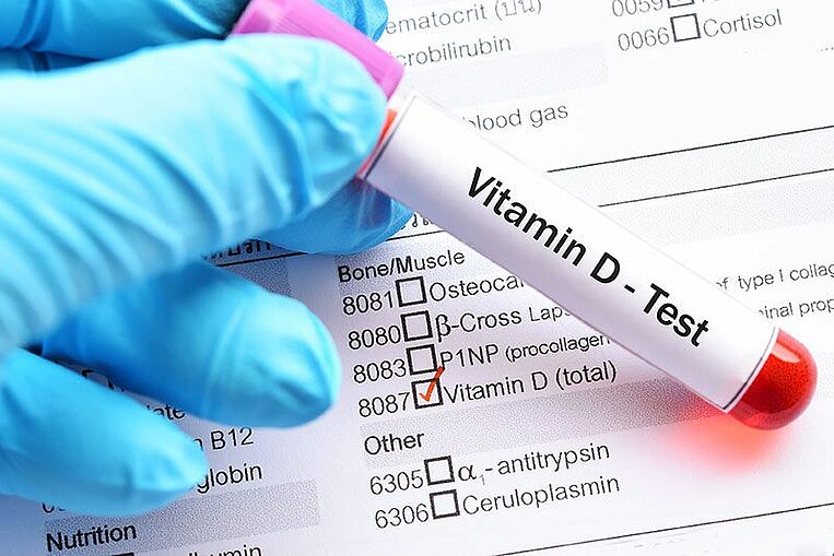 Ein Vitamin-D-Bluttest Ein Vitamin-D-Bluttest