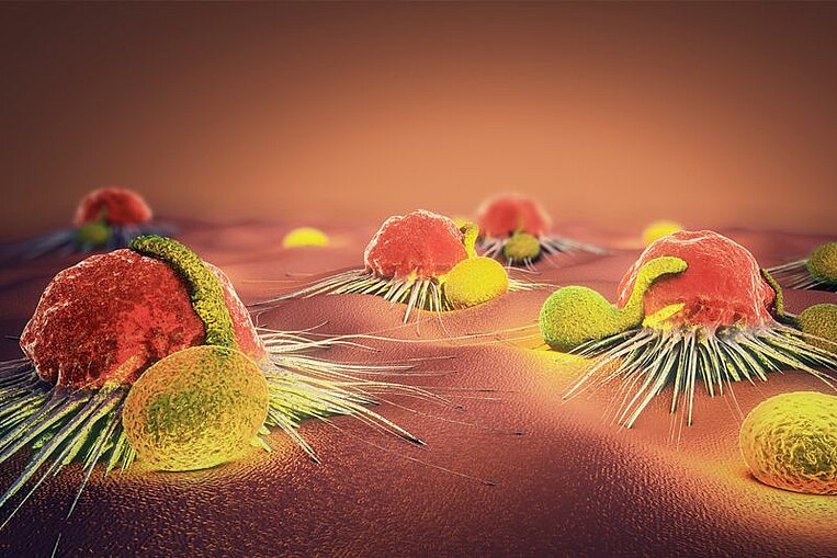 Krebszellen auf einer Leber Krebszellen auf einer Leber