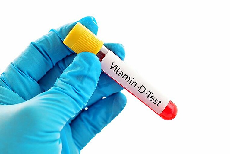 Laborant hält einen Vitamin-D-Test Laborant hält einen Vitamin-D-Test