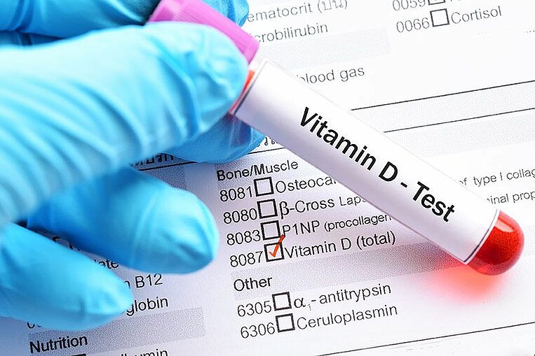 Ampulle mit der Aufschrift Vitamin-D-Test über einem Testblatt Ampulle mit der Aufschrift Vitamin-D-Test über einem Testblatt