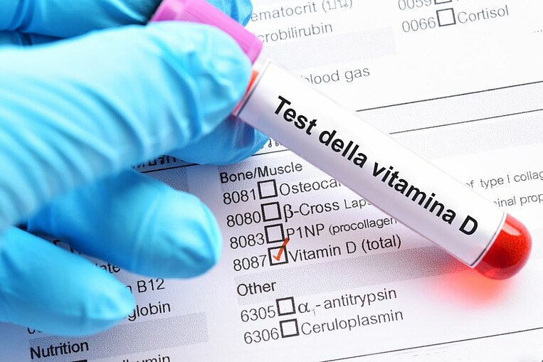 Provetta con la scritta "Test della vitamina D" su una scheda di analisi Provetta con la scritta "Test della vitamina D" su una scheda di analisi