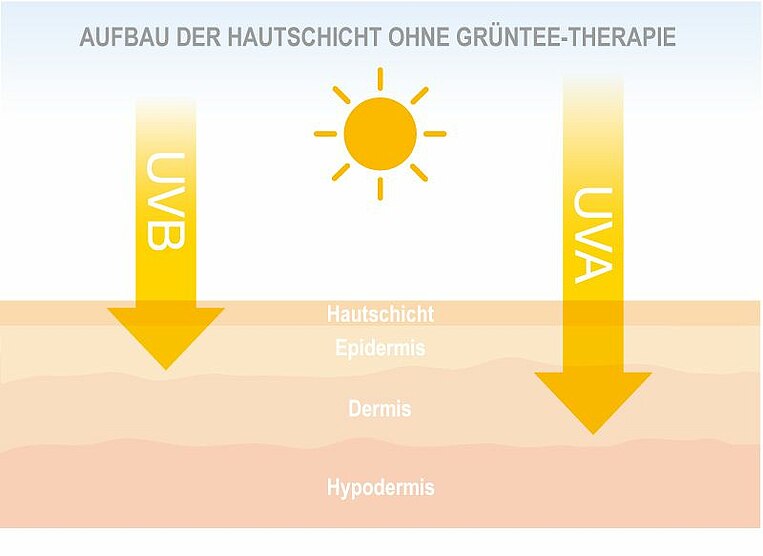 Abbildung zum Aufbau der Hautschicht ohne Grüntee-Therapie bei UV-Strahlungen Abbildung zum Aufbau der Hautschicht ohne Grüntee-Therapie UV-Strahlungen