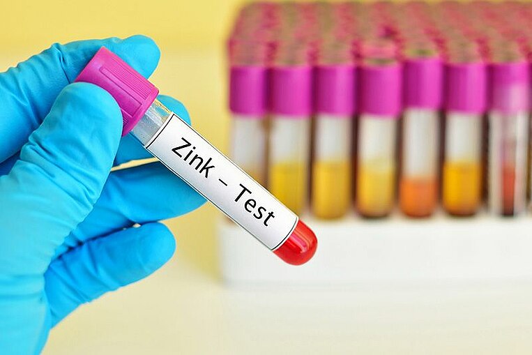 Reagenzglas mit Blut in einer Hand Reagenzglas mit Blut in einer Hand