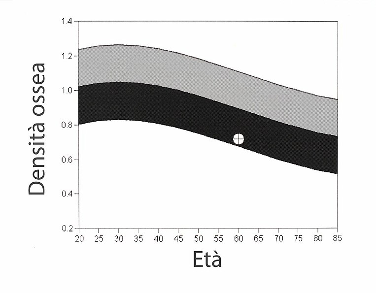 Grafico della densità ossea Grafico della densità ossea
