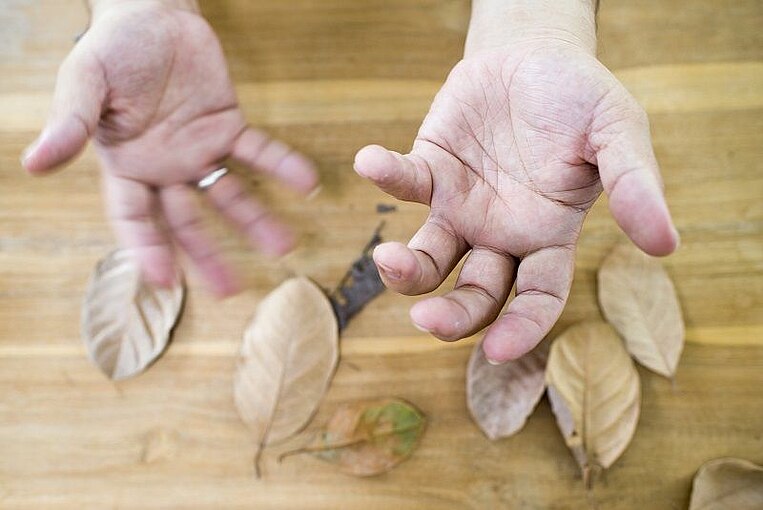 Hände eines Parkinsonerkrankten Hände eines Parkinsonerkrankten