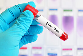 EBV- Test im Labor