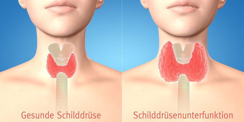 L-Thyroxin und Mikronährstoffe