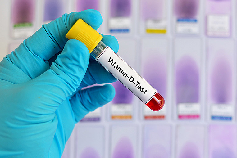Ein Vitamin-D-Bluttest Ein Vitamin-D-Bluttest